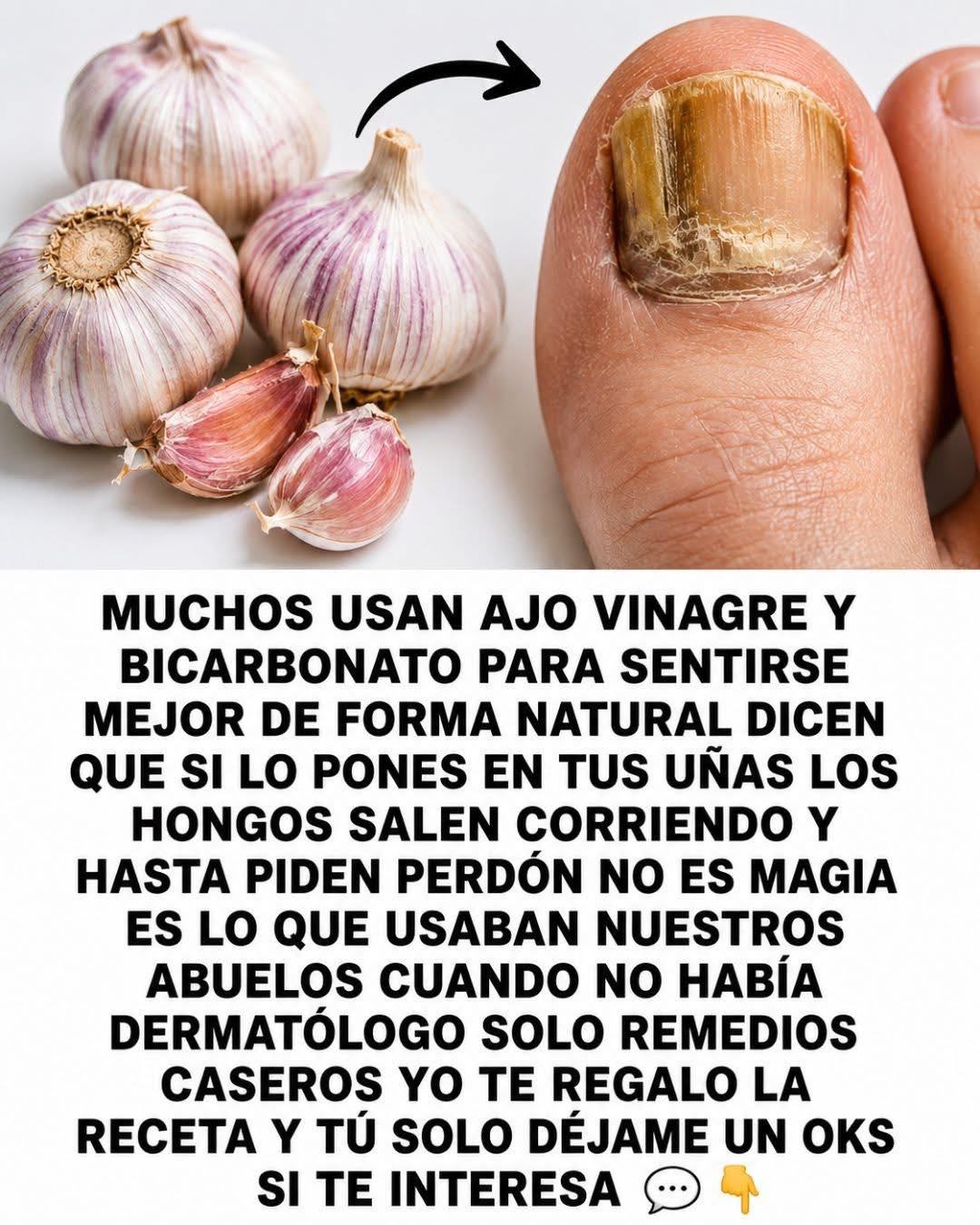El ajo: un remedio natural y efectivo contra los hongos en los pies