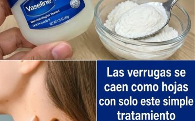 Las verrugas se caen como hojas con este sencillo tratamiento casero…