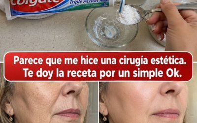 ” Parece que me hice una cirugía estética “: El remedio casero que se usa para mejorar la apariencia de las arrugas y manchas oscuras en manos y brazos. Para seguir recibiendo mis recetas, solo tienes que decir…¡Gracias!