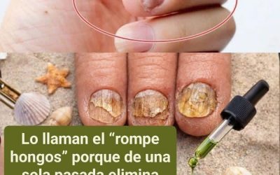 Lo llaman el “rompe hongos” porque de una sola pasada elimina todos los hongos de las uñas del pie. Te doy la receta por un simple OK