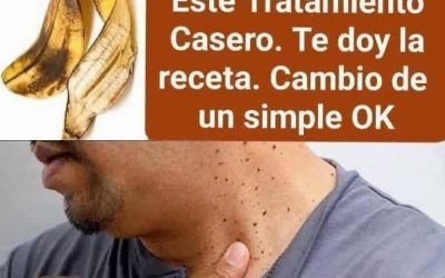 Dile Adiós a las Verrugas