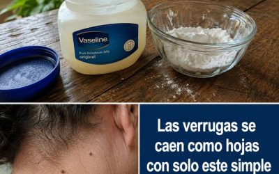 Cómo Eliminar Verrugas de Forma Natural: Remedios Caseros y Consejos Suaves para el Cuidado de la Piel