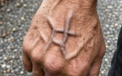 Venas visibles: lo que significan