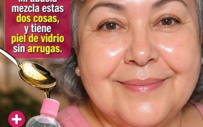 Éstas eran mis manos 15 días antes de aplicar este remedio casero.