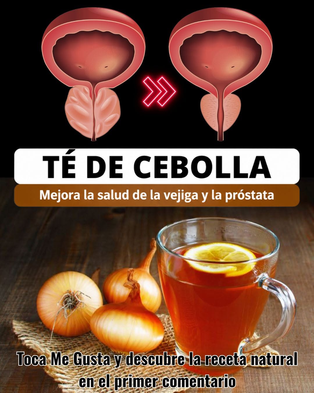 Cómo usar la cebolla y su cáscara para limpiar la próstata y la vejiga